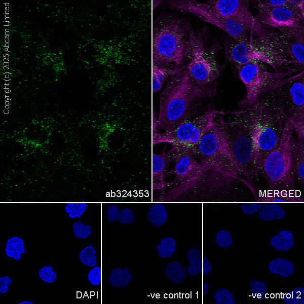 Immunocytochemistry/ Immunofluorescence - Anti-Eph receptor A4/SEK antibody [EPR30307-560] (AB324353)