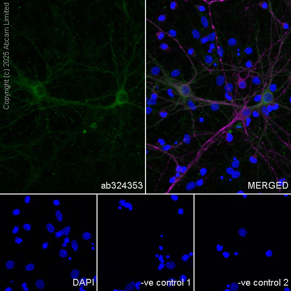 Immunocytochemistry/ Immunofluorescence - Anti-Eph receptor A4/SEK antibody [EPR30307-560] (AB324353)