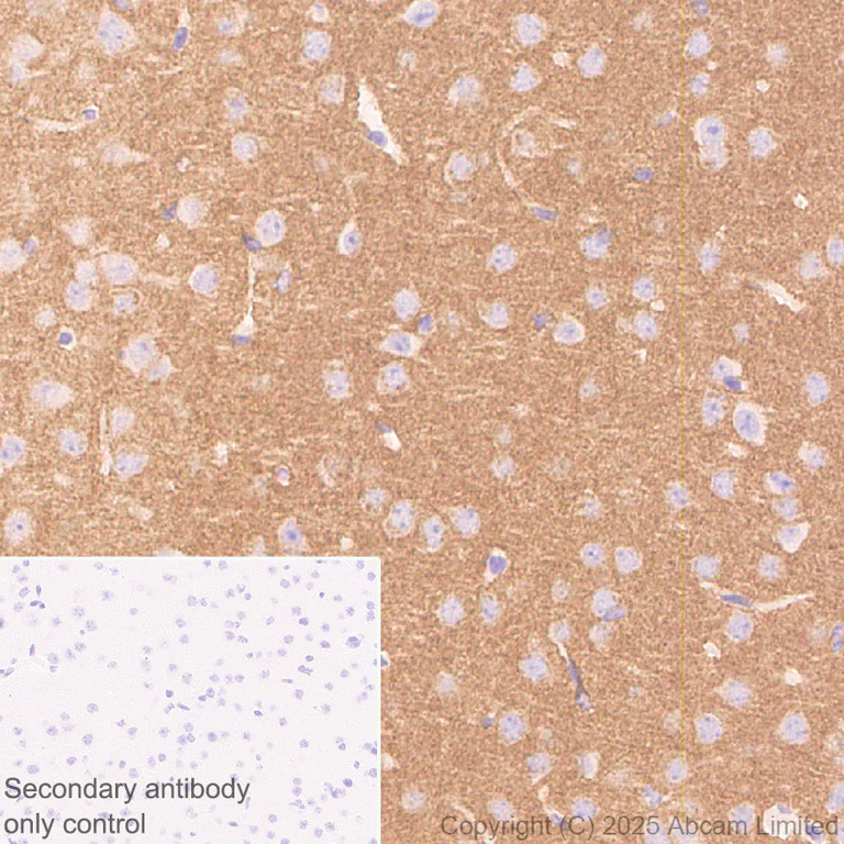 Immunohistochemistry (Formalin/PFA-fixed paraffin-embedded sections) - Anti-Eph receptor A4/SEK antibody [EPR30307-560] (AB324353)