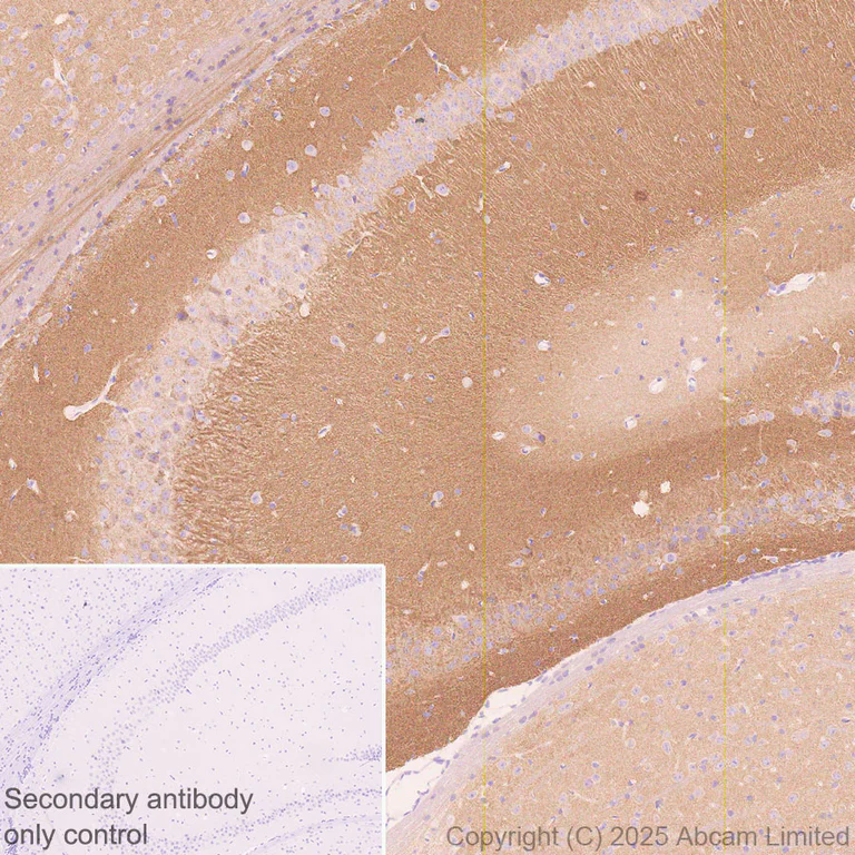Immunohistochemistry (Formalin/PFA-fixed paraffin-embedded sections) - Anti-Eph receptor A4/SEK antibody [EPR30307-560] (AB324353)