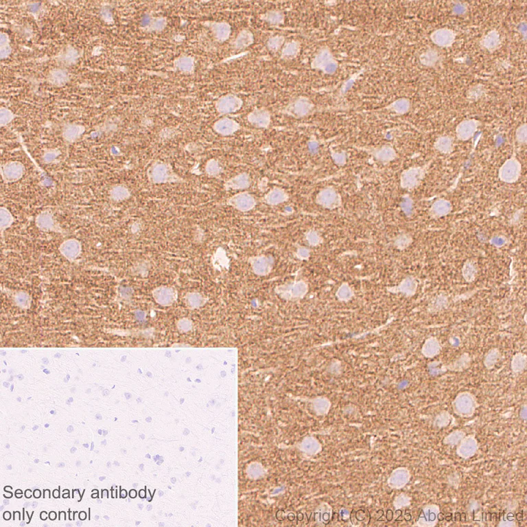 Immunohistochemistry (Formalin/PFA-fixed paraffin-embedded sections) - Anti-Eph receptor A4/SEK antibody [EPR30307-560] (AB324353)