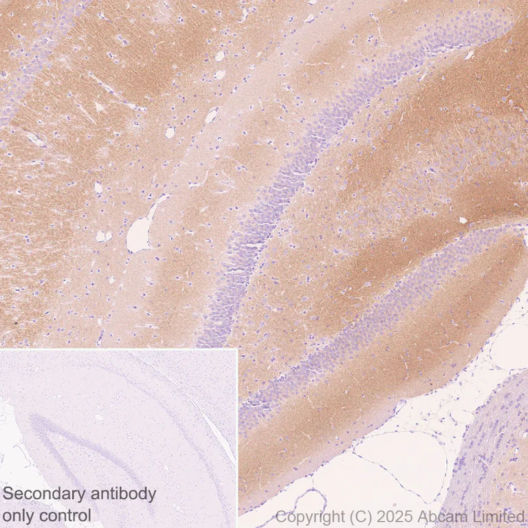 Immunohistochemistry (Formalin/PFA-fixed paraffin-embedded sections) - Anti-Eph receptor A4/SEK antibody [EPR30307-560] (AB324353)