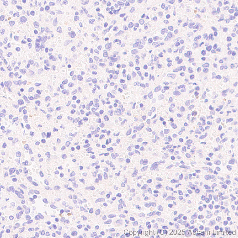 Immunohistochemistry (Formalin/PFA-fixed paraffin-embedded sections) - Anti-Eph receptor A4/SEK antibody [EPR30307-560] (AB324353)