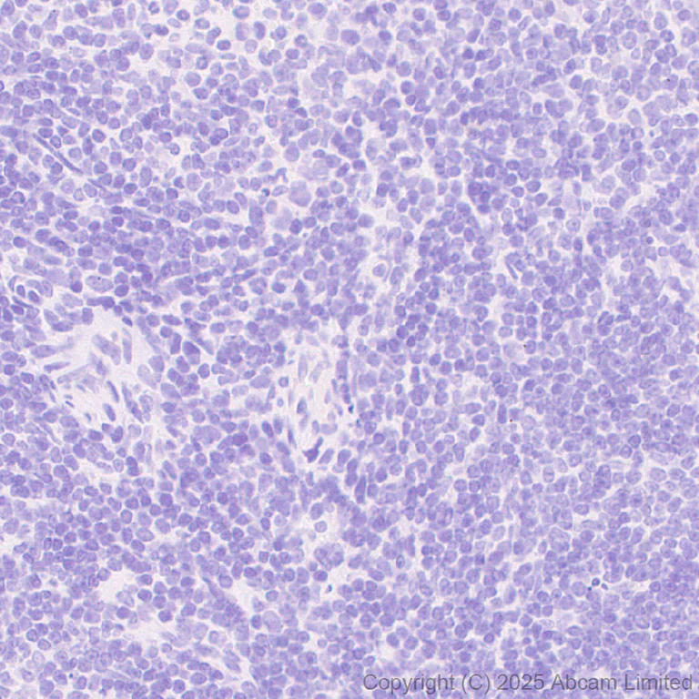 Immunohistochemistry (Formalin/PFA-fixed paraffin-embedded sections) - Anti-Eph receptor A4/SEK antibody [EPR30307-560] (AB324353)
