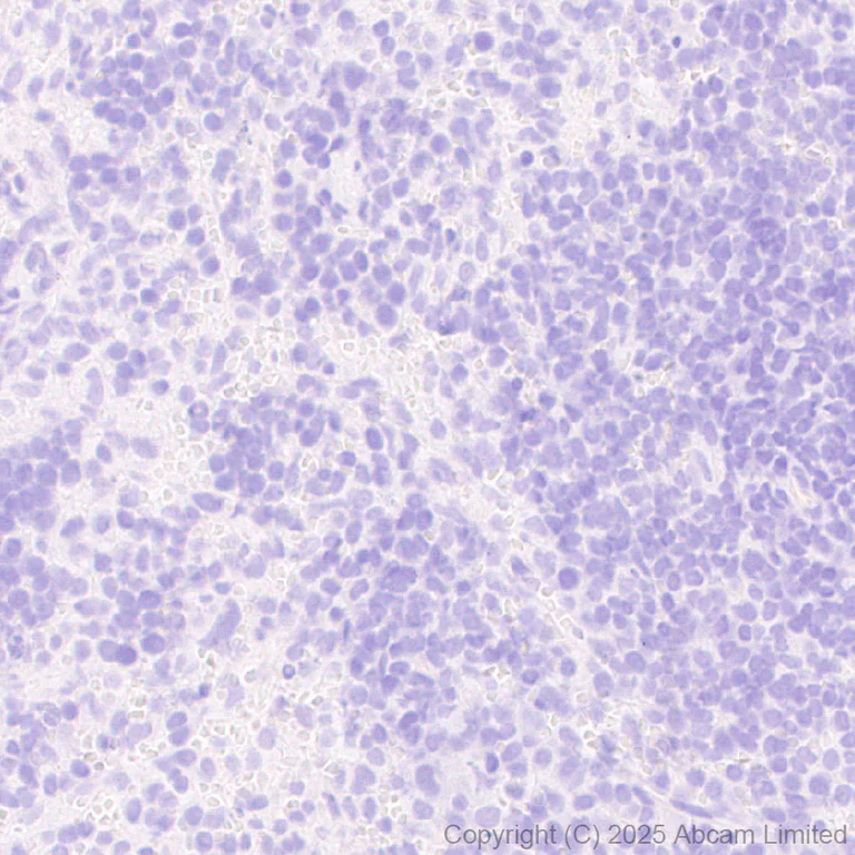 Immunohistochemistry (Formalin/PFA-fixed paraffin-embedded sections) - Anti-Eph receptor A4/SEK antibody [EPR30307-560] (AB324353)
