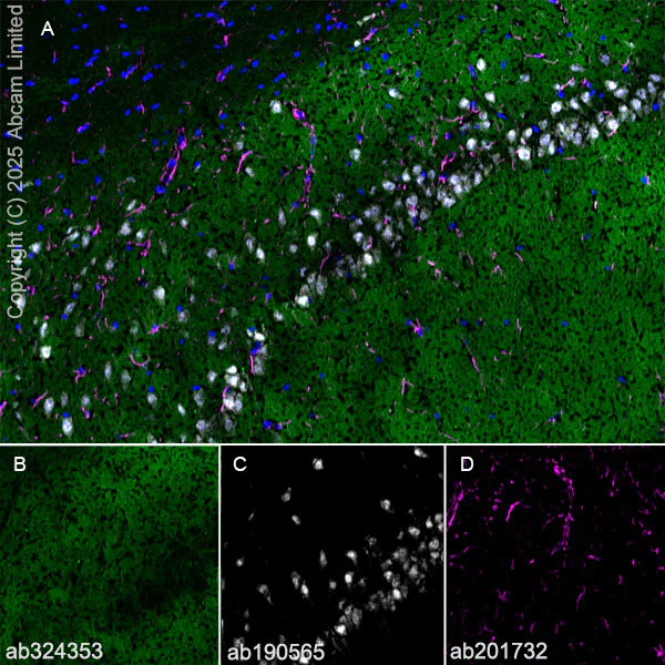 Immunohistochemistry (Frozen sections) - Anti-Eph receptor A4/SEK antibody [EPR30307-560] (AB324353)