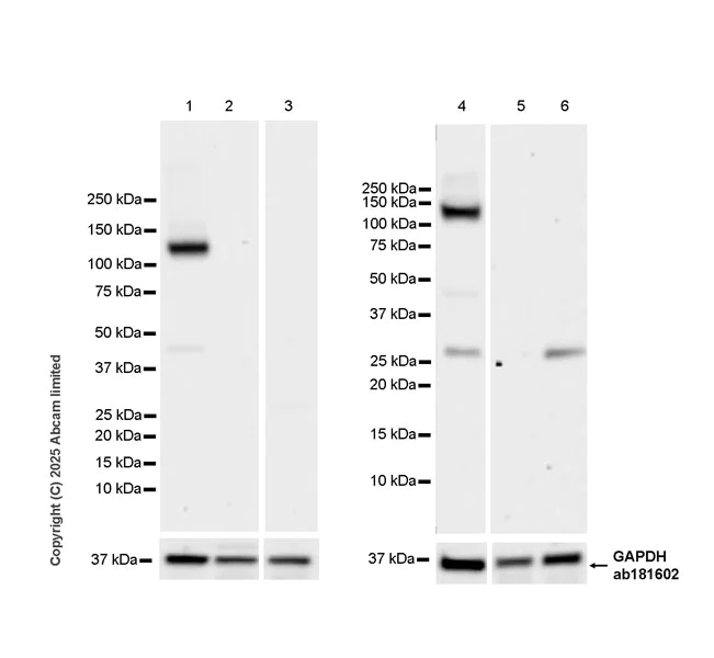 Western blot - Anti-Eph receptor A4/SEK antibody [EPR30307-560] (AB324353)