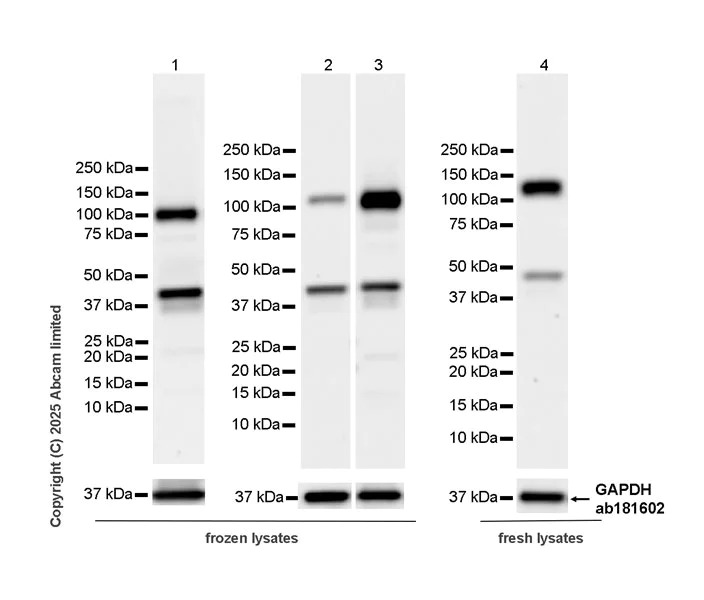 Western blot - Anti-Eph receptor A4/SEK antibody [EPR30307-560] (AB324353)
