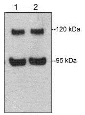 Western blot - Anti-Eph receptor A4/SEK antibody [M280] (AB157588)