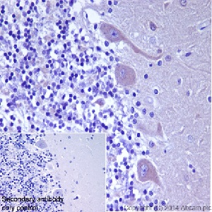 Immunohistochemistry (Formalin/PFA-fixed paraffin-embedded sections) - Anti-Eph receptor A5/BSK antibody [EPR15249] - BSA and Azide free (AB251261)