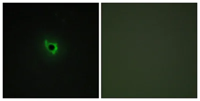 Immunocytochemistry/ Immunofluorescence - Anti-Eph receptor A6 antibody (AB113239)