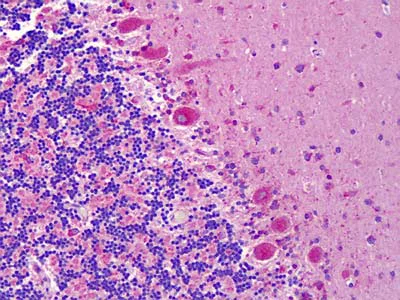 Immunohistochemistry (Formalin/PFA-fixed paraffin-embedded sections) - Anti-Eph receptor A6 antibody (AB113239)