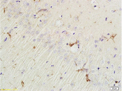 Immunohistochemistry (Formalin/PFA-fixed paraffin-embedded sections) - Anti-Eph receptor A7/EPHA7 antibody (AB204113)