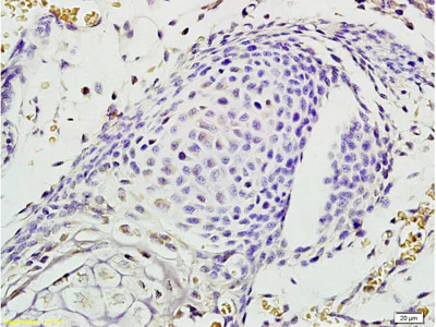 Immunohistochemistry (Formalin/PFA-fixed paraffin-embedded sections) - Anti-Eph receptor A7/EPHA7 antibody (AB204113)