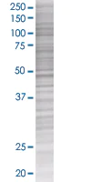 SDS-PAGE - Eph receptor A7/EPHA7 overexpression 293T lysate (whole cell) (AB94177)