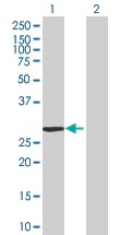Western blot - Eph receptor A7/EPHA7 overexpression 293T lysate (whole cell) (AB94177)