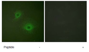 Immunocytochemistry/ Immunofluorescence - Anti-Eph receptor B1 + Eph receptor B2 antibody (AB61765)