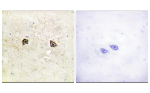 Immunohistochemistry (Formalin/PFA-fixed paraffin-embedded sections) - Anti-Eph receptor B1 + Eph receptor B2 antibody (AB61765)