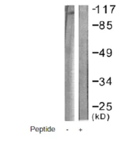 Western blot - Anti-Eph receptor B1 + Eph receptor B2 antibody (AB61765)