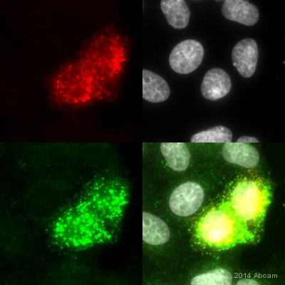 Immunocytochemistry/ Immunofluorescence - Anti-Eph receptor B1 + Eph receptor B2 (phospho Y594 + Y596) antibody (AB61791)