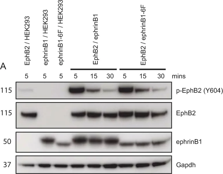 Western blot - Anti-Eph receptor B1 + Eph receptor B2 (phospho Y594 + Y596) antibody (AB61791)