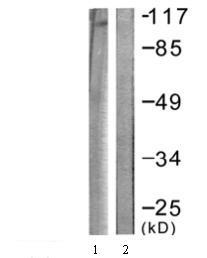 Western blot - Anti-Eph receptor B1 + Eph receptor B2 (phospho Y594 + Y596) antibody (AB61791)