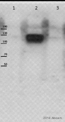 Western blot - Anti-Eph receptor B1 + Eph receptor B2 (phospho Y594 + Y596) antibody (AB61791)