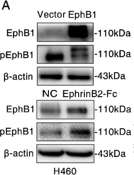 Western blot - Anti-Eph receptor B1/NET antibody [EPR6457] (AB129103)