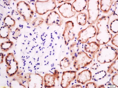 Immunohistochemistry (Formalin/PFA-fixed paraffin-embedded sections) - Anti-Eph receptor B2 antibody (AB216629)
