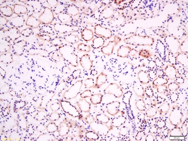Immunohistochemistry (Formalin/PFA-fixed paraffin-embedded sections) - Anti-Eph receptor B2 antibody (AB216629)