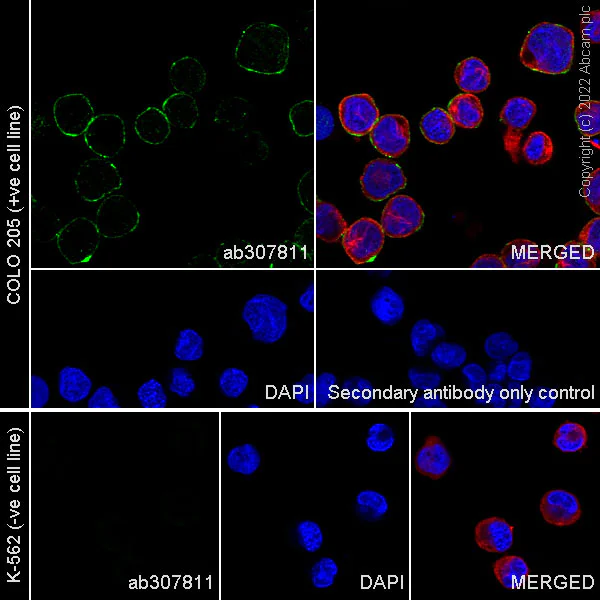 Immunocytochemistry/ Immunofluorescence - Anti-Eph receptor B2 antibody [EPR22422-67] (AB307811)