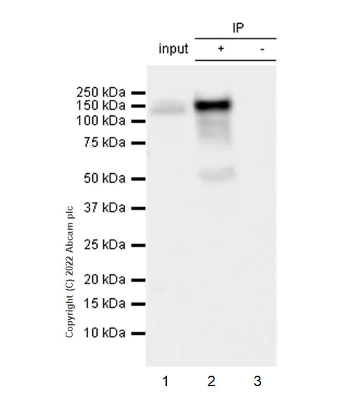 Immunoprecipitation - Anti-Eph receptor B2 antibody [EPR22422-67] (AB307811)
