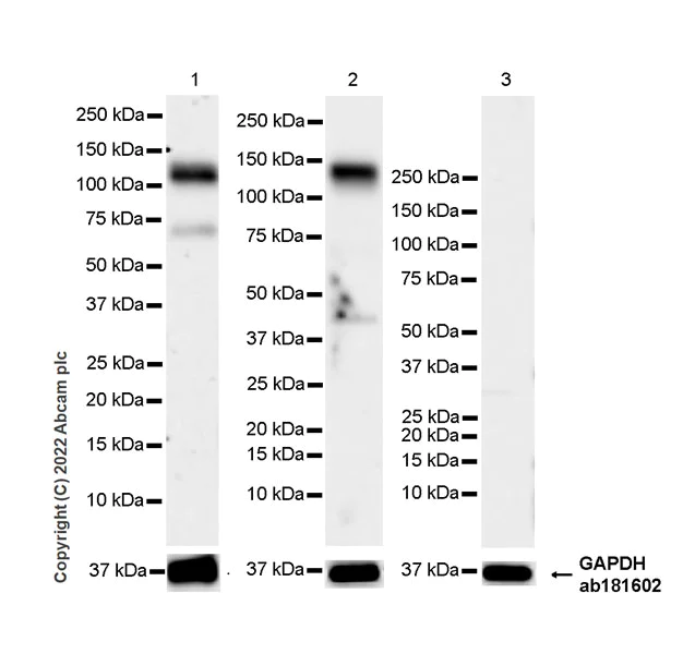 Western blot - Anti-Eph receptor B2 antibody [EPR22422-67] (AB307811)