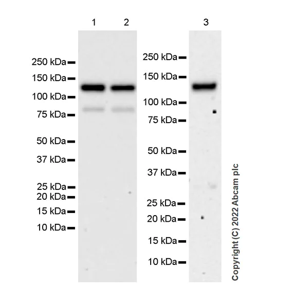 Western blot - Anti-Eph receptor B2 antibody [EPR22422-67] (AB307811)