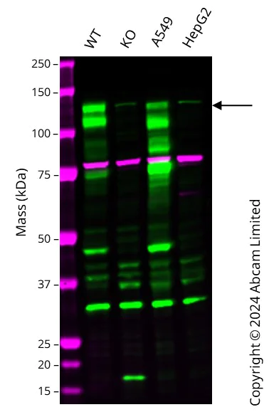 Western blot - Anti-Eph receptor B2 antibody [EPR22422-67] - BSA and Azide free (AB307812)