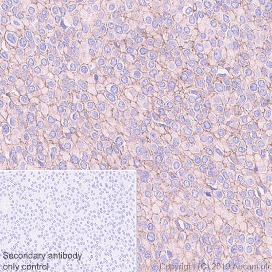 Immunohistochemistry (Formalin/PFA-fixed paraffin-embedded sections) - Anti-Eph receptor B2 antibody [EPR22427-268] - BSA and Azide free (AB255274)