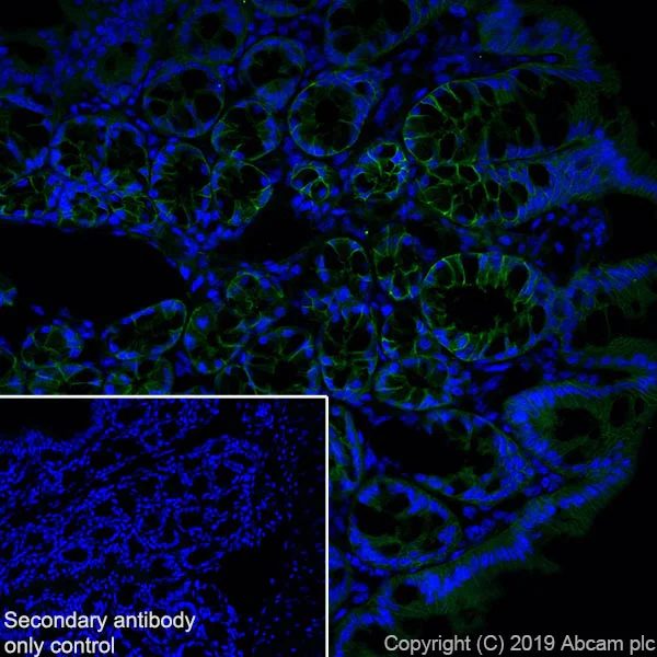 Immunohistochemistry (Frozen sections) - Anti-Eph receptor B2 antibody [EPR22427-268] - BSA and Azide free (AB255274)
