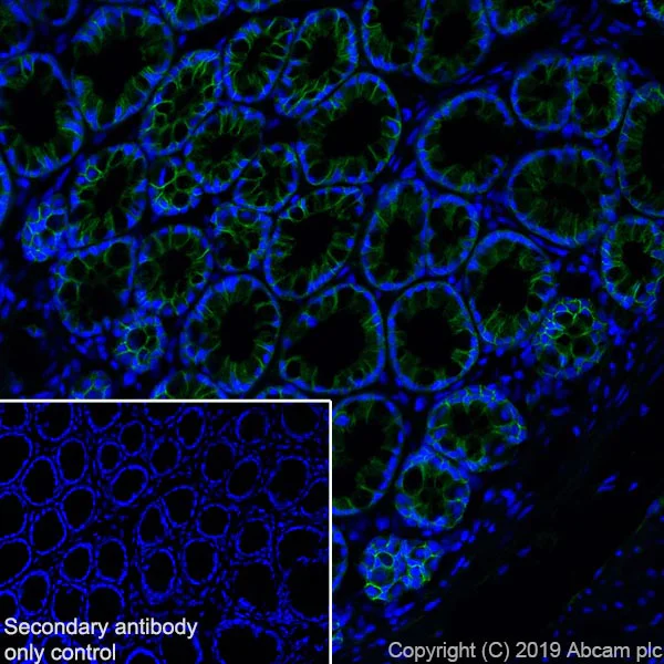 Immunohistochemistry (Frozen sections) - Anti-Eph receptor B2 antibody [EPR22427-268] - BSA and Azide free (AB255274)