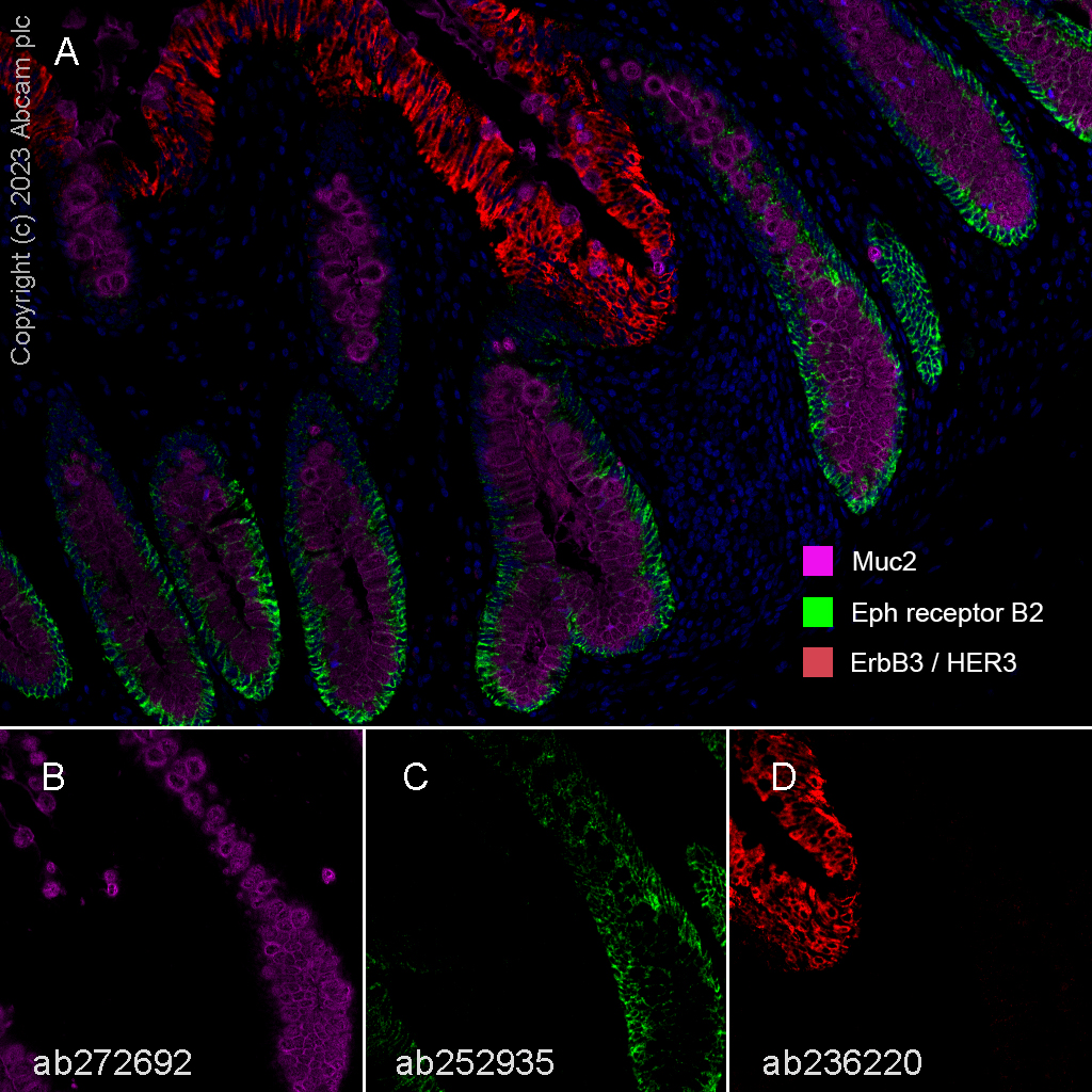 Multiplex immunohistochemistry - Anti-Eph receptor B2 antibody [EPR22427-268] - BSA and Azide free (AB255274)
