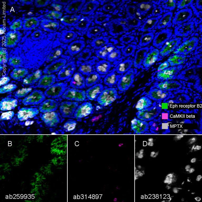 Multiplex immunohistochemistry - Anti-Eph receptor B2 antibody [EPR22427-268] - BSA and Azide free (AB255274)