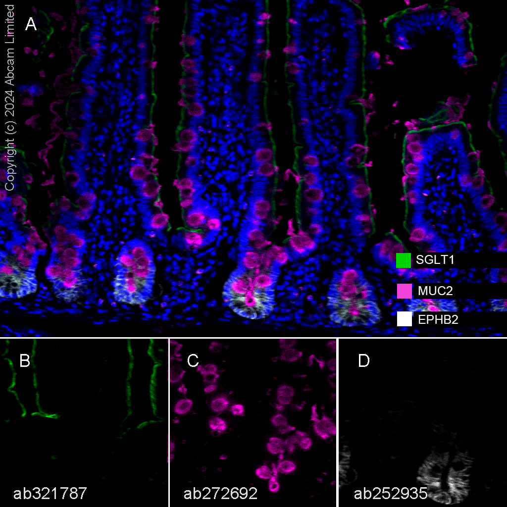 Multiplex immunohistochemistry - Anti-Eph receptor B2 antibody [EPR22427-268] - BSA and Azide free (AB255274)