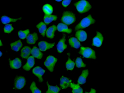 Immunocytochemistry/ Immunofluorescence - Anti-Eph receptor B3 antibody [EPR8280] (AB133742), expandable thumbnail