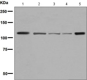 Western blot - Anti-Eph receptor B3 antibody [EPR8280] (AB133742), expandable thumbnail