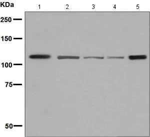 Western blot - Anti-Eph receptor B3 antibody [EPR8280] (AB133742)