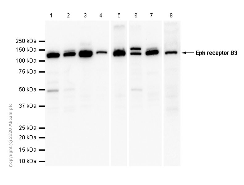 Western blot - Anti-Eph receptor B3 antibody [EPR8280] - BSA and Azide free (AB248634), expandable thumbnail