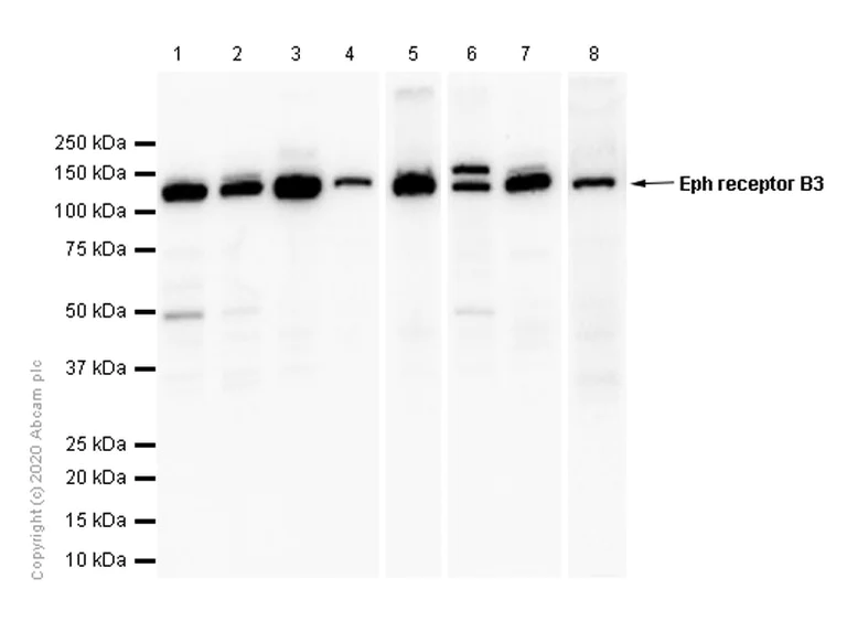 Western blot - Anti-Eph receptor B3 antibody [EPR8280] - BSA and Azide free (AB248634)