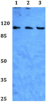 Western blot - Anti-Eph receptor B3 (phospho Y608) antibody (AB191502)