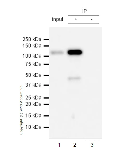 Immunoprecipitation - Anti-Eph receptor B4/HTK antibody [EPR23221-54] (AB254300)