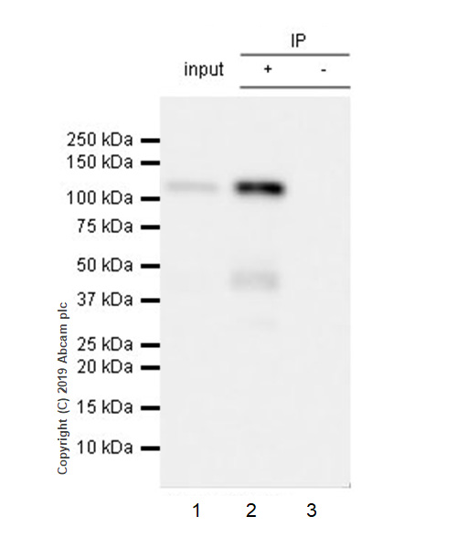 Immunoprecipitation - Anti-Eph receptor B4/HTK antibody [EPR23221-54] (AB254300)