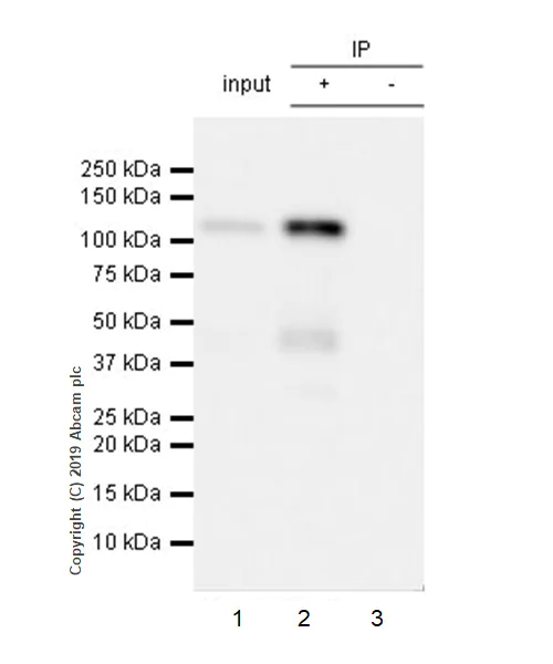 Immunoprecipitation - Anti-Eph receptor B4/HTK antibody [EPR23221-54] (AB254300)